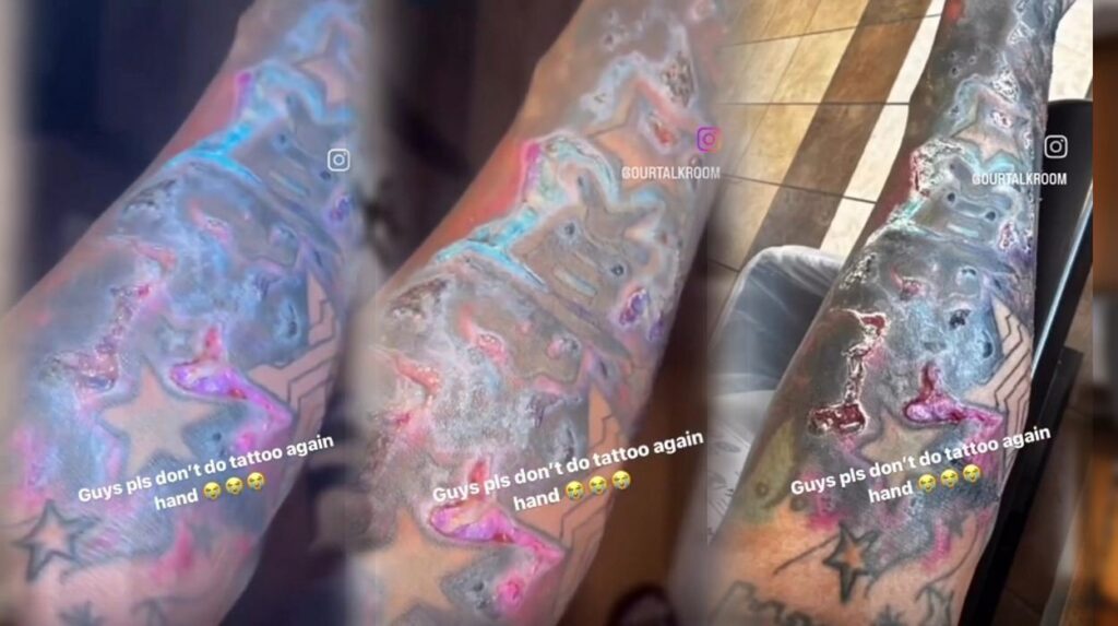 Images of a tattoo decaying hand