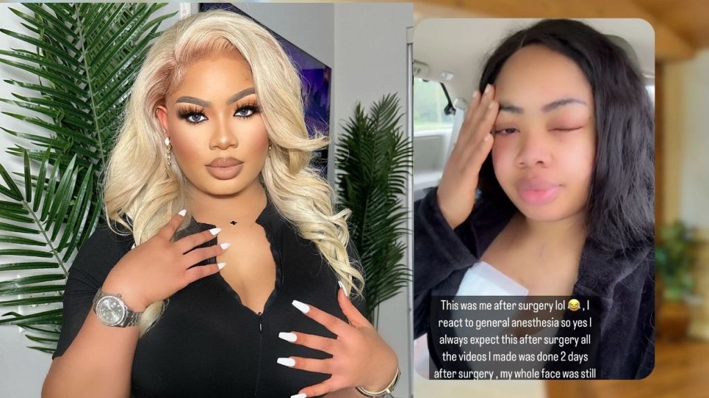 Headshot of BBNaija Nina [left]. Screenshot showing Nina's post-surgery face reaction [right]