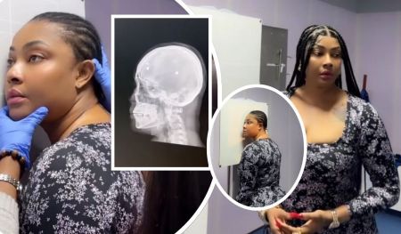 Actress Angela Okorie undergoes a hospital check-up, with a close-up of her wearing a floral dress and blue gloves, alongside an X-ray of a skull, and various poses showing her in the medical setting.