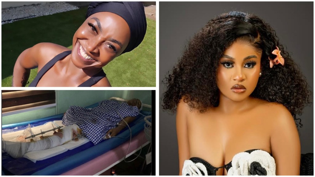 Kate Henshaw in a headwrap outdoors;Phyna’s sister on a bed with a heavily bandaged leg and external fixator; and a studio portrait of Phyna wearing a flower hair clip.