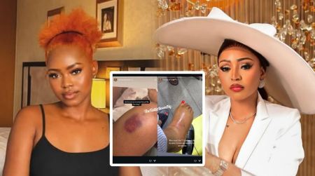 Side-by-side photo of Destiny Daniels and Regina Daniels, with an inset showing bruises and a swollen foot allegedly shared by Destiny on Instagram.
