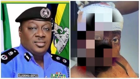 Rivers State Commissioner of Police, Olugbenga Adepoju, alongside an image showing the injured woman reportedly stabbed by her lover, with her face partially pixelated for privacy.