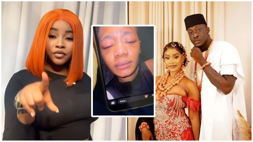 A split-screen collage featuring media personality Jojooflele on the left pointing at the camera; a central inset showing a close-up of Carter Efe's baby mama, Ella, with a swollen and bruised face; and a photo on the right of Carter Efe and Ella posing together in traditional Nigerian attire.