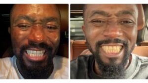 Ice Prince marks four months without smoking: Rapper shares dental win